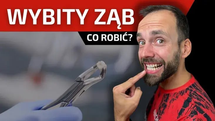 Kadr z&nbsp;filmu: Co zrobić po wybiciu zęba?